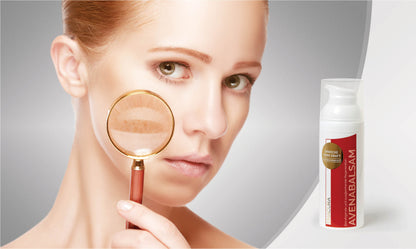 Avenabalsam für Problemhaut - starkes Geshcütz